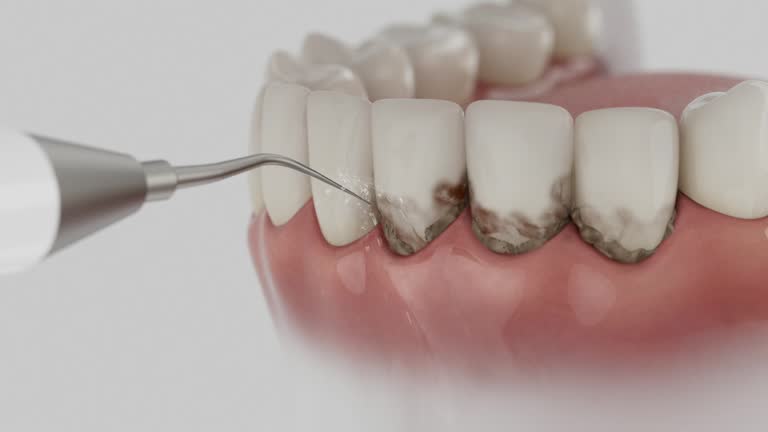 Trusted Wisdom Tooth Removal service in Vassar College, NY - Dentist Open Now